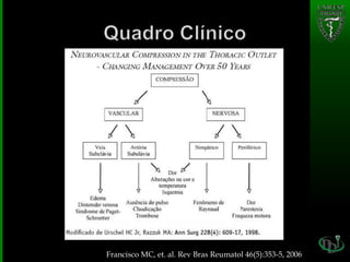 Francisco MC, et. al. Rev Bras Reumatol 46(5):353-5, 2006
 