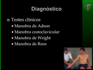  Testes clínicos
 Manobra de Adson
 Manobra costoclavicular
 Manobra de Wright
 Manobra de Roos
 