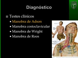  Testes clínicos
 Manobra de Adson
 Manobra costoclavicular
 Manobra de Wright
 Manobra de Roos
 