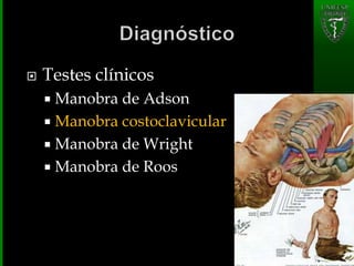  Testes clínicos
 Manobra de Adson
 Manobra costoclavicular
 Manobra de Wright
 Manobra de Roos
 