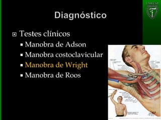  Testes clínicos
 Manobra de Adson
 Manobra costoclavicular
 Manobra de Wright
 Manobra de Roos
 