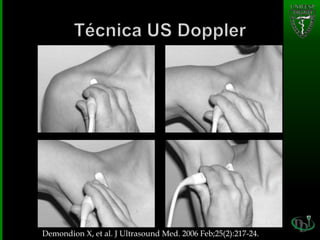 Demondion X, et al. J Ultrasound Med. 2006 Feb;25(2):217-24.
 