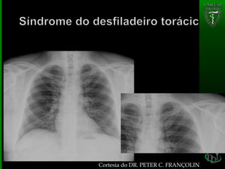 Cortesia do DR. PETER C. FRANÇOLIN
 