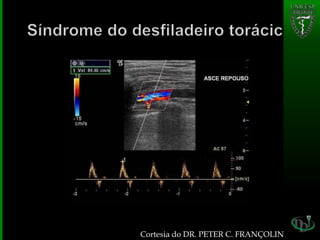 Cortesia do DR. PETER C. FRANÇOLIN
 