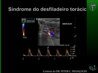 Cortesia do DR. PETER C. FRANÇOLIN
 