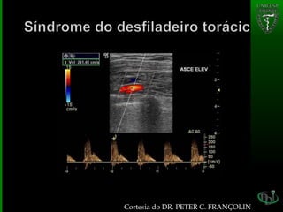 Cortesia do DR. PETER C. FRANÇOLIN
 