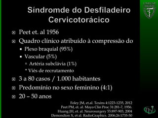  Peet et. al 1956
 Quadro clínico atribuído à compressão do
 Plexo braquial (95%)
 Vascular (5%)
 Artéria subclávia (1%)
* Viés de recrutamento
 3 a 80 casos / 1.000 habitantes
 Predomínio no sexo feminino (4:1)
 20 – 50 anos
Foley JM, et.al. Toxins 4:1223-1235, 2012
Peet PM, et. al. Mayo Clin Proc 31:281-7, 1956.
Huang JH, et. al. Neurosurgery 55:897-903, 2004
Demondion X, et al. RadioGraphics. 2006;26:1735-50
 