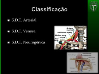  S.D.T. Arterial
 S.D.T. Venosa
 S.D.T. Neurogênica
 
