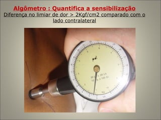 Algômetro : Quantifica a sensibilização Diferença no limiar de dor > 2Kgf/cm2 comparado com o lado contralateral 