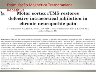Estimulação Magnética Transcraniana Repetitiva 