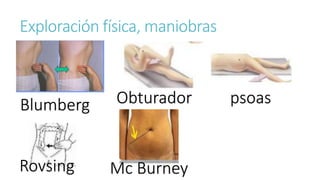 Exploración física, maniobras
Blumberg Obturador psoas
Rovsing Mc Burney
 