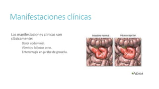 Manifestaciones clínicas
Las manifestaciones clínicas son
clásicamente:
Dolor abdominal.
Vómitos biliosos o no.
Enterorragia en jarabe de grosella.
 