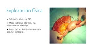 Exploración física
• Palpación Vacío en FID.
• Masa palpable alargada en
hipocondrio derecho.
• Tacto rectal: dedil manchado de
sangre, prolapso.
 