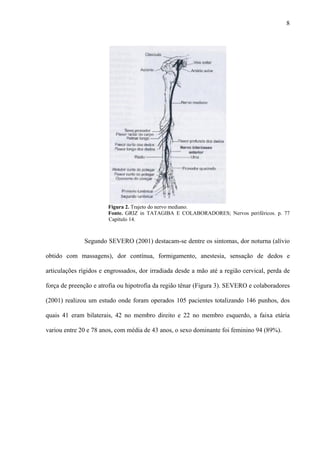 8
Figura 2. Trajeto do nervo mediano.
Fonte. GRIZ in TATAGIBA E COLABORADORES; Nervos periféricos. p. 77
Capítulo 14.
Segundo SEVERO (2001) destacam-se dentre os sintomas, dor noturna (alívio
obtido com massagens), dor contínua, formigamento, anestesia, sensação de dedos e
articulações rígidos e engrossados, dor irradiada desde a mão até a região cervical, perda de
força de preenção e atrofia ou hipotrofia da região tênar (Figura 3). SEVERO e colaboradores
(2001) realizou um estudo onde foram operados 105 pacientes totalizando 146 punhos, dos
quais 41 eram bilaterais, 42 no membro direito e 22 no membro esquerdo, a faixa etária
variou entre 20 e 78 anos, com média de 43 anos, o sexo dominante foi feminino 94 (89%).
 