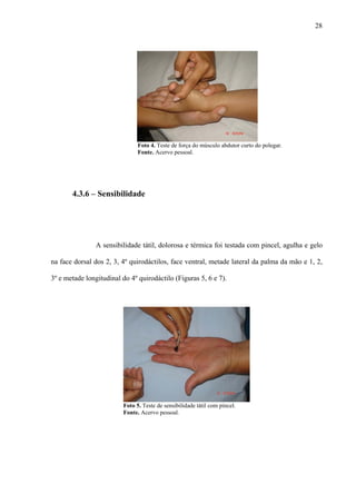 28
Foto 4. Teste de força do músculo abdutor curto do polegar.
Fonte. Acervo pessoal.
4.3.6 – Sensibilidade
A sensibilidade tátil, dolorosa e térmica foi testada com pincel, agulha e gelo
na face dorsal dos 2, 3, 4º quirodáctilos, face ventral, metade lateral da palma da mão e 1, 2,
3º e metade longitudinal do 4º quirodáctilo (Figuras 5, 6 e 7).
Foto 5. Teste de sensibilidade tátil com pincel.
Fonte. Acervo pessoal.
 