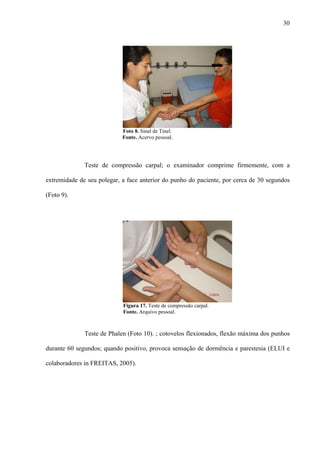 30
Foto 8. Sinal de Tinel.
Fonte. Acervo pessoal.
Teste de compressão carpal; o examinador comprime firmemente, com a
extremidade de seu polegar, a face anterior do punho do paciente, por cerca de 30 segundos
(Foto 9).
Figura 17. Teste de compressão carpal.
Fonte. Arquivo pessoal.
Teste de Phalen (Foto 10). ; cotovelos flexionados, flexão máxima dos punhos
durante 60 segundos; quando positivo, provoca sensação de dormência e parestesia (ELUI e
colaboradores in FREITAS, 2005).
 