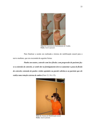 33
Foto 12. Exercícios de Deslizamento de Tendão.
Fonte. Acervo pessoal.
Para finalizar a sessão era realizada a técnica de mobilização neural para o
nervo mediano, que era executada da seguinte forma:
Punho em neutro, cotovelo com leve flexão; com progressão do paciente faz-
se a extensão de cotovelo, se sentir dor ou formigamento deve-se aumentar o grau de flexão
do cotovelo; extensão de punho e dedos apoiados na parede solicita-se ao paciente que ele
realize uma rotação externa de ombro (Foto 13, 14 e 15).
Foto 13. Técnica de Mobilização neural.
Fonte. Acervo pessoal.
 