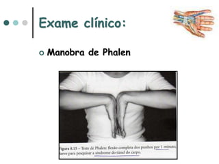 Exame clínico:
 Manobra de Phalen
 