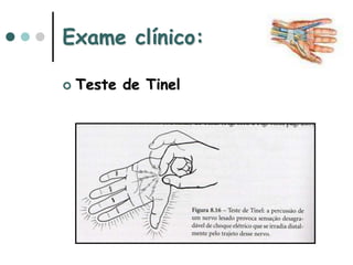 Exame clínico:
 Teste de Tinel
 