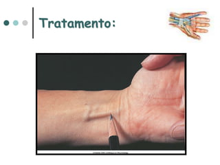 Tratamento:
 