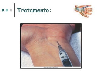 Tratamento:
 