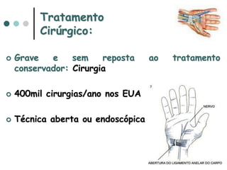 Tratamento
Cirúrgico:
 Grave e sem reposta ao tratamento
conservador: Cirurgia
 400mil cirurgias/ano nos EUA
 Técnica aberta ou endoscópica
 