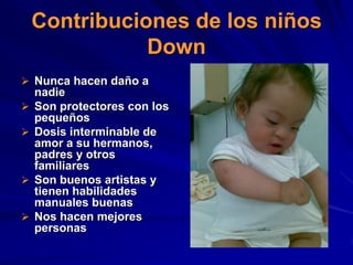 Contribuciones de los niños
               Down
 Nunca hacen daño a
    nadie
   Son protectores con los
    pequeños
   Dosis interminable de
    amor a su hermanos,
    padres y otros
    familiares
   Son buenos artistas y
    tienen habilidades
    manuales buenas
   Nos hacen mejores
    personas
 