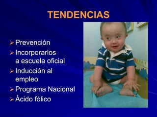 TENDENCIAS

 Prevención
 Incorporarlos
  a escuela oficial
 Inducción al
  empleo
 Programa Nacional
 Ácido fólico
 