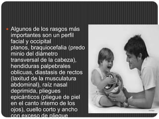  Algunos de los rasgos más
 importantes son un perfil
 facial y occipital
 planos, braquiocefalia (predo
 minio del diámetro
 transversal de la cabeza),
 hendiduras palpebrales
 oblicuas, diastasis de rectos
 (laxitud de la musculatura
 abdominal), raíz nasal
 deprimida, pliegues
 epicánticos (pliegue de piel
 en el canto interno de los
 ojos), cuello corto y ancho
 con exceso de pliegue
 