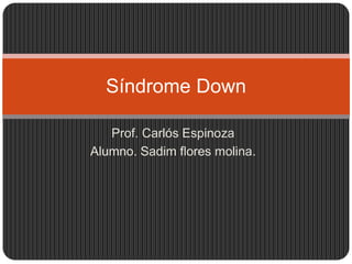 Síndrome Down

   Prof. Carlós Espinoza
Alumno. Sadim flores molina.
 
