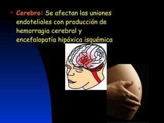 Cerebro:   Se afectan las uniones endoteliales con producción de hemorragia cerebral y encefalopatía hipóxica isquémica 