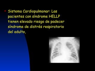 Sistema Cardiopulmonar: Las pacientes con síndrome HELLP tienen elevado riesgo de padecer síndrome de distrés respiratorio del adulto, 