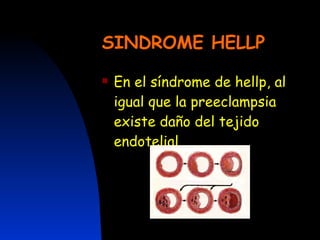 SINDROME HELLP En el síndrome de hellp, al igual que la preeclampsia existe daño del tejido endotelial 