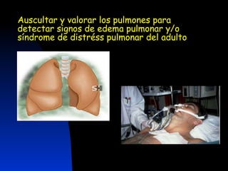 Auscultar y valorar los pulmones para detectar signos de edema pulmonar y/o síndrome de distréss pulmonar del adulto 