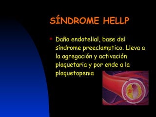 SÍNDROME HELLP Daño endotelial, base del síndrome preeclamptico. Lleva a la agregación y activación plaquetaria y por ende a la plaquetopenia 