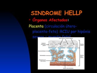 SINDROME  HELLP Órganos Afectados : Placenta   (circulación útero-placenta-feto) :RCIU por hipóxia severa = muerte fetal 