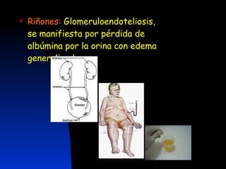 Riñones:   Glomeruloendoteliosis,  se manifiesta por pérdida de albúmina por la orina con edema generalizado 