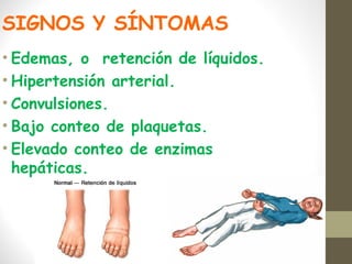SIGNOS Y SÍNTOMAS
• Edemas, o retención de líquidos.
• Hipertensión arterial.
• Convulsiones.
• Bajo conteo de plaquetas.
• Elevado conteo de enzimas
hepáticas.
 