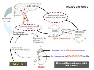 HÍGADO CIRRÓTICOALBÚMINA
Disminución de la
producción de albúmina
Aumento de la presión
portal
ASCITIS
Capilar mesentérico
RIÑON
Exudación
de Linfa
Aumento de la Aldosterona Adrenal
Incremento de la REABSORCIÓN de Na+
Sistema Renina Angiotensina
Aldosterona
 