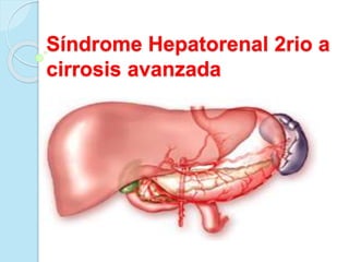 Síndrome Hepatorenal 2rio a
cirrosis avanzada
 