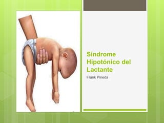 Síndrome
Hipotónico del
Lactante
Frank Pineda
 