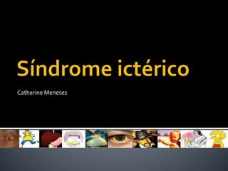 Síndrome ictérico Catherine Meneses 