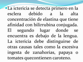 La ictericia se detecta primero en la
 esclera    debido     a    la   alta
 concentración de elastina que tiene
 afinidad con bilirrubina conjugada.
 El segundo lugar donde se
 encuentra es debajo de la lengua.
 La ictericia debe distinguirse de
 otras causas tales como la excesiva
 ingesta de zanahorias, papaya o
 tomates quecontienen caroteno.
 