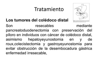 Síndrome ictérico obstructivo | PPTX