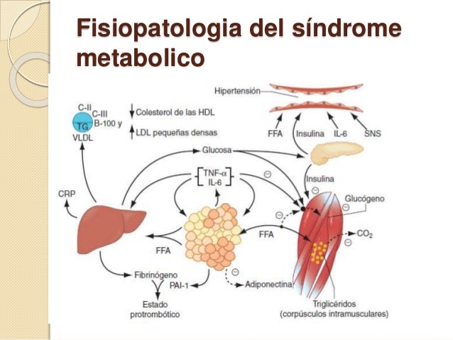 Síndrome metabólico Síndrome metabólico