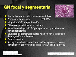 GN focal y segmentaria
 Una de las formas más comunes en adultos
 Proteinuria importante              HTA 50%
 Idiopática v/s 2ª a hiperfiltración
 70% no respondedora a corticoides
 Mutación en el gen NPHS2 para podocina, que determina
  corticorresistencia
 Severidad de proteinuria guarda relación con la velocidad
  de progresión a falla renal
 Peor pronóstico
 No hay tratamiento con evidencia clínica probada. Uso de
  corticoides + ciclofosfamida (no en forma 2ª) por 6-12 meses
 