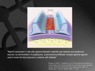 “Nephrin expression in rats with passive Heymann nephritis was restored and proteinuria
reduced, by adminstration of pioglitazone, a peroxisome-proliferator receptor-gamma agonist
used to lower the blood glucose in patients with diabetes”

                                              Benigni, A, Zoja, C, Tomasoni, S, et al. Transcriptional regulation of
                                              nephrin gene by peroxisome proliferator-activated receptor-{gamma}
                                              agonist: molecular mechanism of the antiproteinuric effect of
                                              pioglitazone. J Am Soc Nephrol 2006; 17:1624.
 