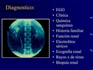 Diagnostico: <br />EGO<br />Clínica<br />Química sanguínea<br />Historia familiar<br />Función renal<br />Electrolitos sér...