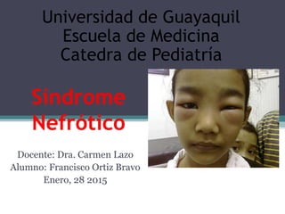 Síndrome
Nefrótico
Docente: Dra. Carmen Lazo
Alumno: Francisco Ortiz Bravo
Enero, 28 2015
Universidad de Guayaquil
Escuela de Medicina
Catedra de Pediatría
 