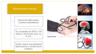 Hipertensión arterial.
Retención hidrosalina,
volumen dependiente
Se acompaña de EFNa <1%
(parece prerrenal, pero no
lo es).
Puede causar encefalopatía
hipertensiva e insuﬁciencia
cardíaca.
 